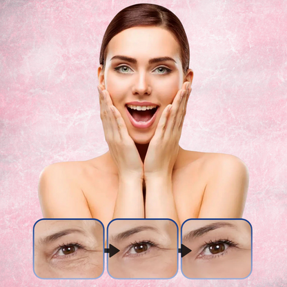 Botox Stock Solution – Anti-Wrinkle Face Serum (30ml)